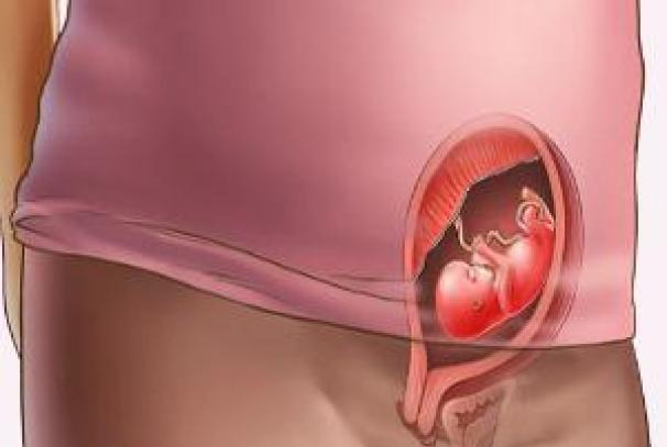 Potrat (spontánní potrat)